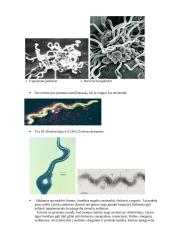 Laimo ligos borelijos 4 puslapis