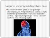 Gydymas kamieninėmis ląstelėmis 13 puslapis