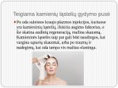 Gydymas kamieninėmis ląstelėmis 17 puslapis