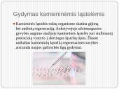 Gydymas kamieninėmis ląstelėmis 4 puslapis