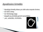 Kirmėlė – tai bestuburis bekojis gyvūnas 5 puslapis