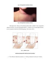 Meningokokine infekcija sergančiųjų vaikų slauga 7 puslapis