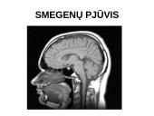 Nervų sistemos valdymas 19 puslapis
