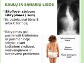 Atramos ir judėjimo organų sistema 11 puslapis