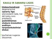 Atramos ir judėjimo organų sistema 10 puslapis