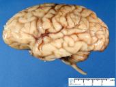 Galvos smegenys - teorija 3 puslapis