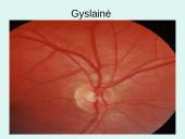Akis - regėjimo organas  11 puslapis