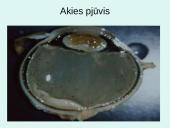 Akis - regėjimo organas  13 puslapis