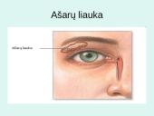 Akis - regėjimo organas  18 puslapis