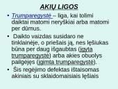 Akis - regėjimo organas  20 puslapis