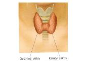 Apie endokrininę sistemą 11 puslapis