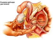 Dauginimosi organai 11 puslapis