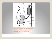 Inkstų terapija dializė 8 puslapis