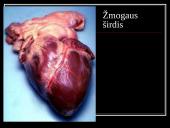 Kraują varinėja širdis 3 puslapis