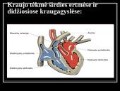 Kraują varinėja širdis 10 puslapis