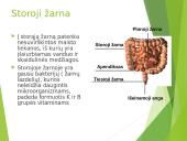 Virškinimas – fizinis ir cheminis maisto apdorojimas 18 puslapis