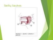 Virškinimas – fizinis ir cheminis maisto apdorojimas 10 puslapis