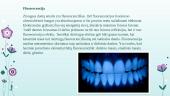 Dantų estetika, natūralių dantų optinės savybės 18 puslapis