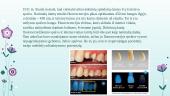Dantų estetika, natūralių dantų optinės savybės 19 puslapis