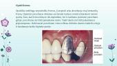 Dantų estetika, natūralių dantų optinės savybės 20 puslapis