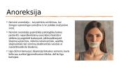 Anoreksija. Bulimija. Gastritas. Opaligė 2 puslapis
