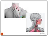 Pirmoji pagalba nuodingoms ir pavojingoms medžiagoms patekus, pro burną, per odą, į akis, kvėpavimo takus 13 puslapis