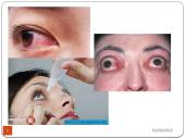 Pirmoji pagalba nuodingoms ir pavojingoms medžiagoms patekus, pro burną, per odą, į akis, kvėpavimo takus 17 puslapis