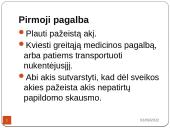 Pirmoji pagalba nuodingoms ir pavojingoms medžiagoms patekus, pro burną, per odą, į akis, kvėpavimo takus 18 puslapis