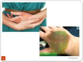 Pirmoji pagalba nuodingoms ir pavojingoms medžiagoms patekus, pro burną, per odą, į akis, kvėpavimo takus 9 puslapis