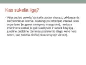 Vėjaraupiai – tai ūminė virusinė liga 4 puslapis