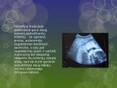 Abortas ir filosofija 3 puslapis