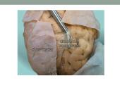 Galvos smegenų sandara ir kraujotaka 12 puslapis