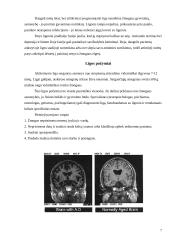Alzheimerio liga ir jos profilaktika 7 puslapis