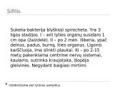 Dažnesnės ligos bei jų profilaktika 11 puslapis