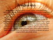 Skaidrės apie žmogaus akis 3 puslapis