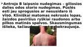 Odos nudegimai 12 puslapis