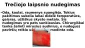 Odos nudegimai 13 puslapis