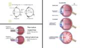 Akis – regos organas 11 puslapis