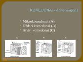 Veide lokalizuotų odos ligų diagnostikos ir gydymo principai 12 puslapis