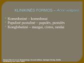 Veide lokalizuotų odos ligų diagnostikos ir gydymo principai 15 puslapis