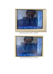 Šakotosios grandinės tyrimas 2 puslapis
