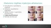 Grožio injekcijos 12 puslapis