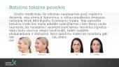 Grožio injekcijos 4 puslapis