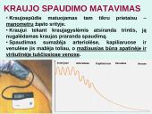 Širdis. Širdies darbo ciklas. Elektrokardiograma 15 puslapis