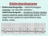 Širdis. Širdies darbo ciklas. Elektrokardiograma 18 puslapis