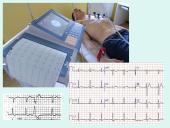 Širdis. Širdies darbo ciklas. Elektrokardiograma 19 puslapis