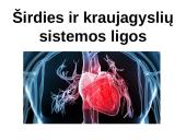 Širdies ir kraujagyslių sistemos ligos Lietuvoje
