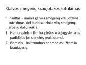Širdies ir kraujagyslių sistemos ligos Lietuvoje 11 puslapis