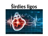 Širdies ir kraujagyslių sistemos ligos Lietuvoje 13 puslapis