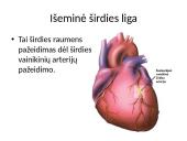 Širdies ir kraujagyslių sistemos ligos Lietuvoje 14 puslapis